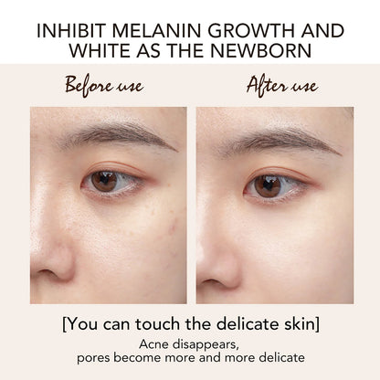Kojic Acid Brightening Foam Cleanser