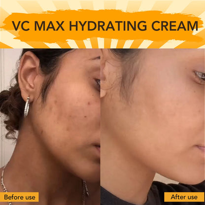 Vitamin C Brightening Skincare Set