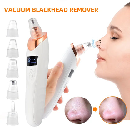 Vacuum Blackhead & Pimple Remover