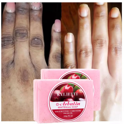 Dark Spot Removal Whitening Soap