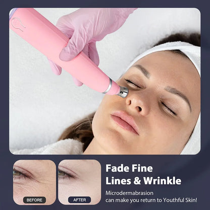 Portable Diamond Peeling Facial Device