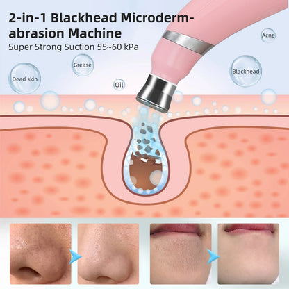 Portable Diamond Peeling Facial Device