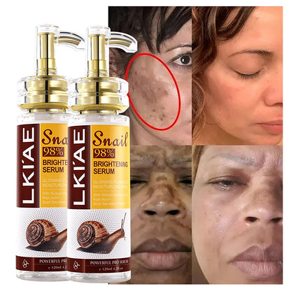 Snail 98% Whitening Face Serum