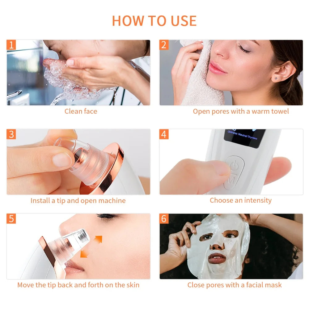 Vacuum Blackhead & Pimple Remover
